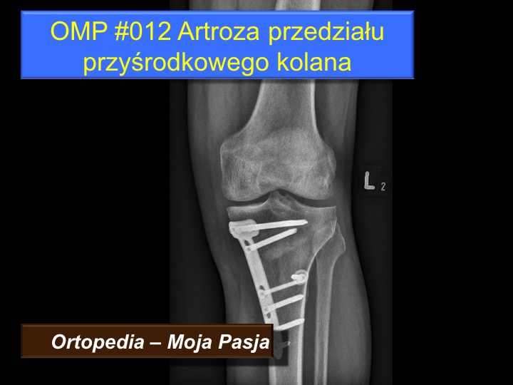 inflamatie articulara homeopatie durere la nivelul piciorului inferior sub genunchi